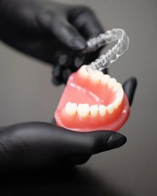 Alineador transparente colocado sobre un modelo dental